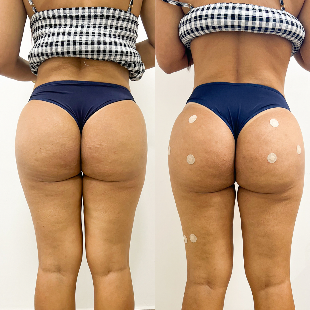 2CFD3CFF-DFF4-4DD5-B41E-C409F045827B