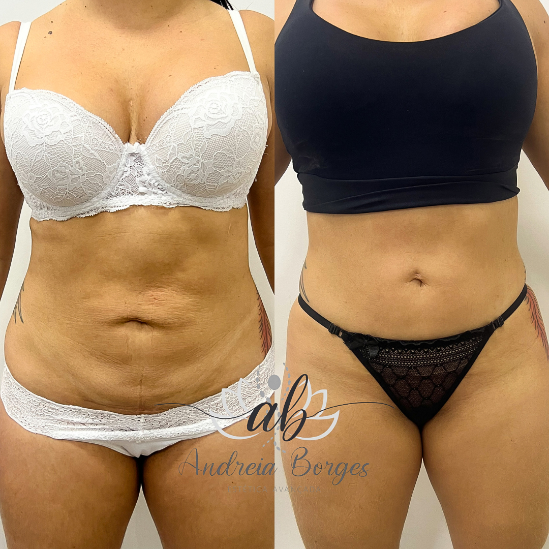 7B2777EA-8D5D-4680-A409-C8EA0459116A