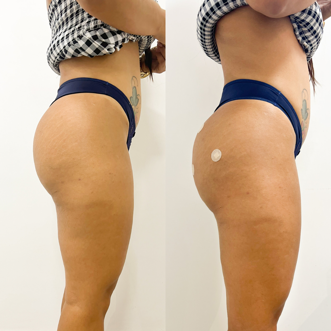 F71BC313-C467-4B64-B841-68A5C10E035F